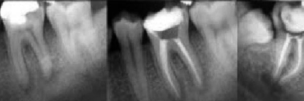 odontologia-preventiva1