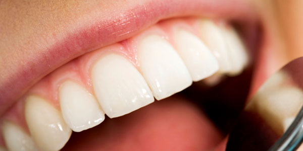 terapia-mucogingival